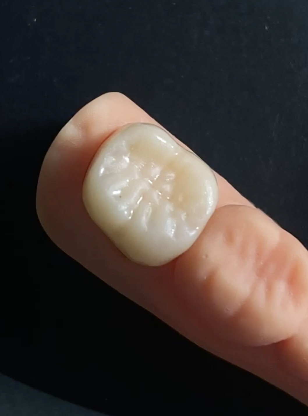 implantes Dra Darchuk