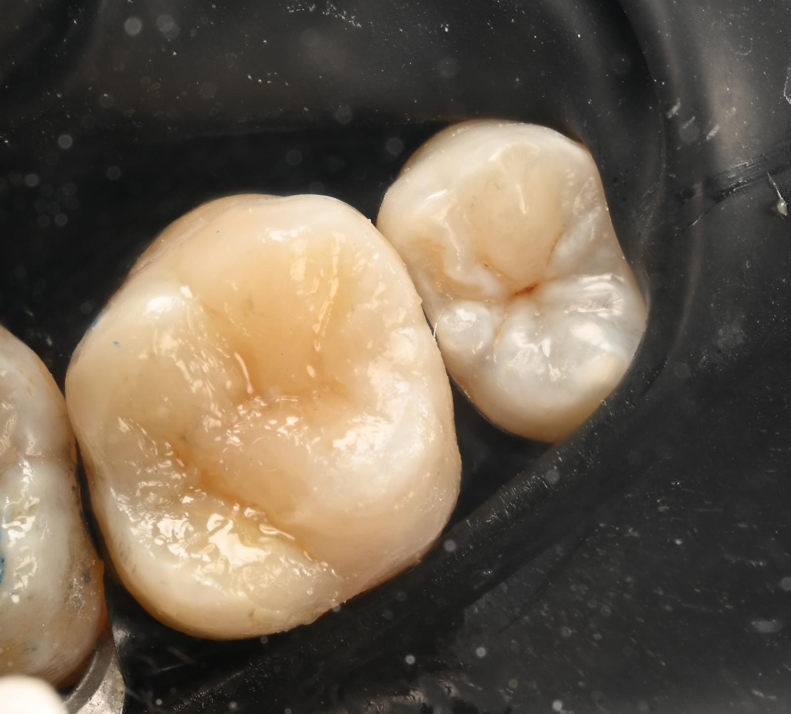 implantes dentales dra darchuk cei