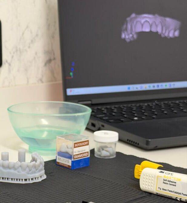 modelado 3d implantes